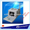 cheap portable echo sounder manufacturers for pregnancy (DW3101A)